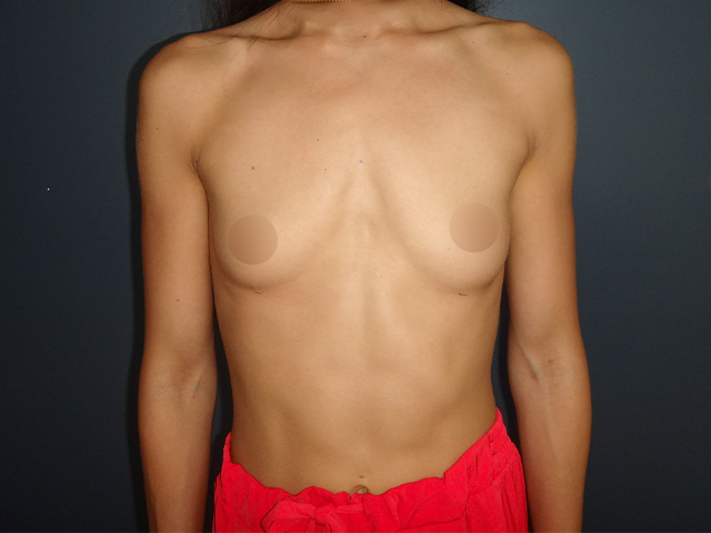 Antes