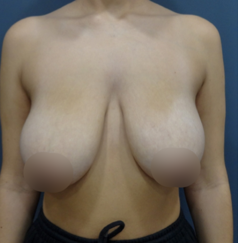 Antes